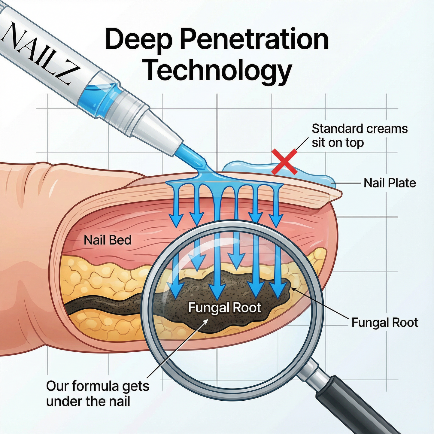 Nailz Anti-Fungus Pen